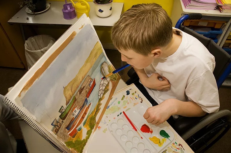 臨床表明:干細胞移植是一種很有前途的腦癱治療方法 臨床表明:干細胞移植是一種很有前途的腦癱治療方法