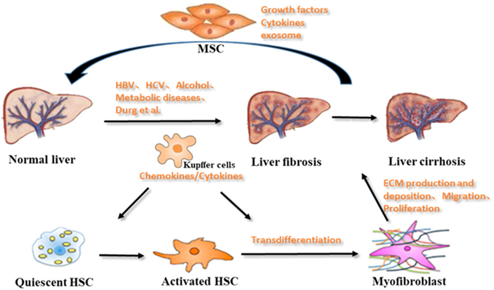 肝纖維化的形成機制 肝纖維化的形成機制