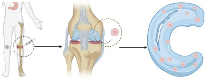 圖1：干細胞注射方法的過程示意圖。