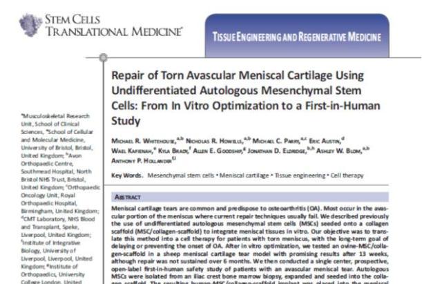 間充質干細胞能夠幫助修復受損的半月板組織，不用手術切除受傷部位也能讓膝關節功能恢復正常。