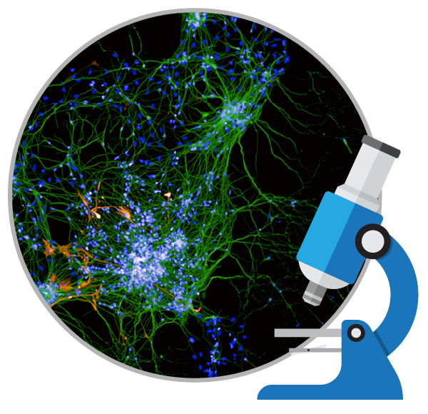 干細胞能治療好阿爾茨海默癥嗎?