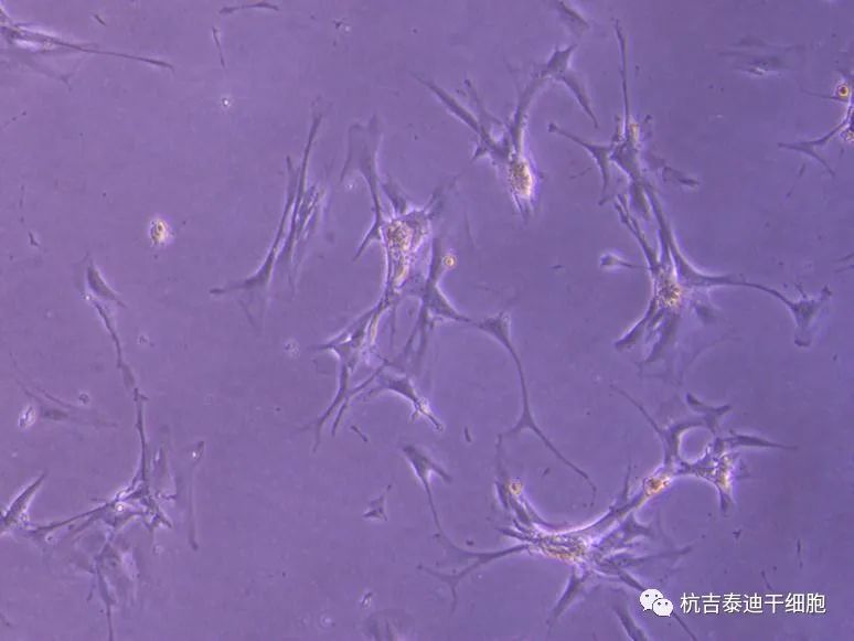 可能的腎臟干細(xì)胞，在實(shí)驗(yàn)室中生長