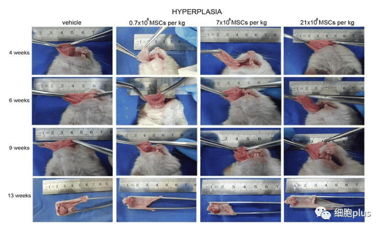 全身注射同種異體間充質干細胞不會加速癌前病變的進展