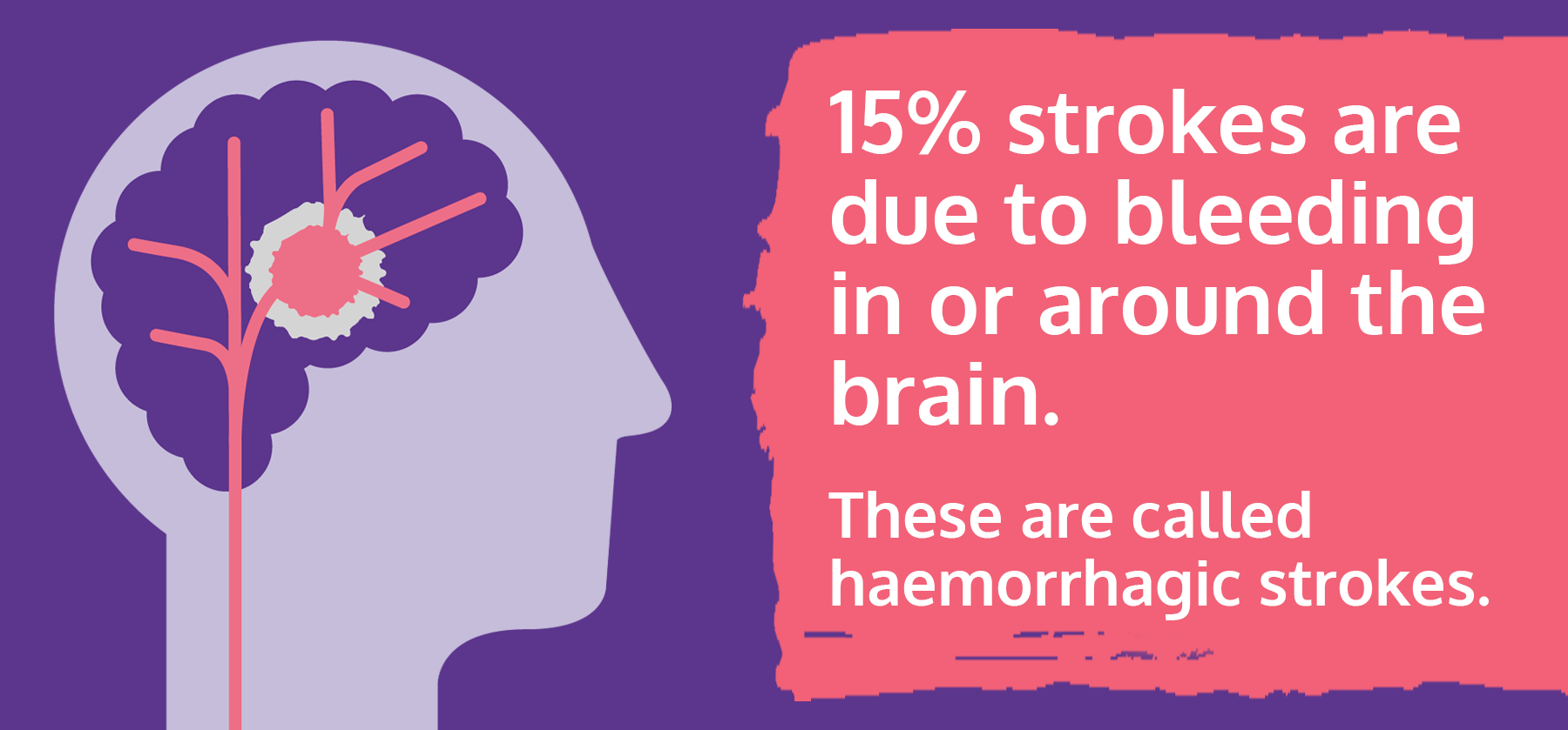 什么是出血性中風(fēng)?