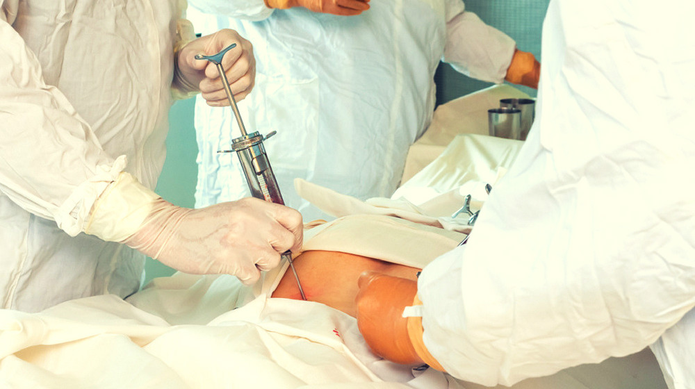 關于自體干細胞移植的須知 關于自體干細胞移植的須知