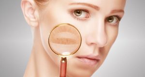 間充質(zhì)干細(xì)胞治療系統(tǒng)性紅斑狼瘡 間充質(zhì)干細(xì)胞治療系統(tǒng)性紅斑狼瘡