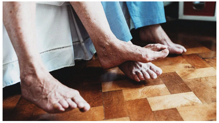 什么是類風濕關節炎？癥狀，治療，原因以及你需要知道的一切