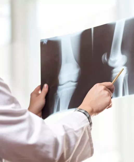 膝關節疼痛診斷和測試