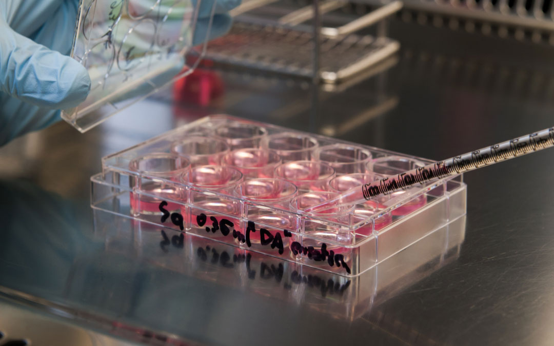 踝關節疼痛的干細胞療法