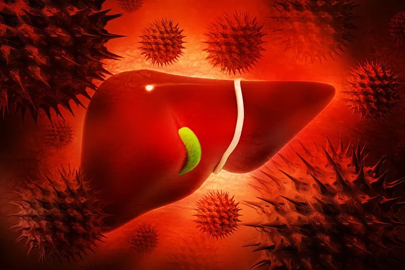 慢性肝病 (CLD) – 原因、癥狀、可用的治療方法 慢性肝病 (CLD) – 原因、癥狀、可用的治療方法