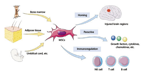 間充質(zhì)干細(xì)胞治療神經(jīng)退行性疾病的機(jī)制 間充質(zhì)干細(xì)胞治療神經(jīng)退行性疾病的機(jī)制