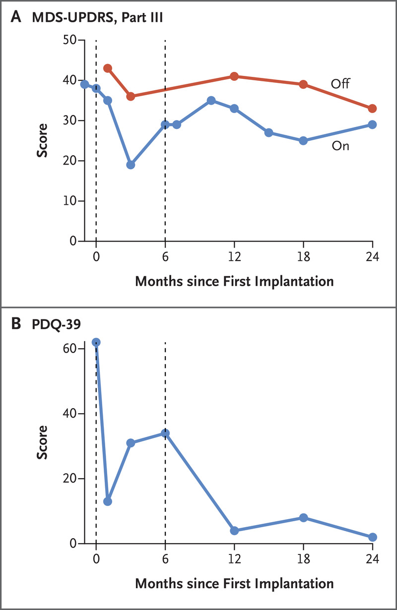 圖3.帕金森病相關(guān)運(yùn)動(dòng)能力和生活質(zhì)量的橫向臨床評估。