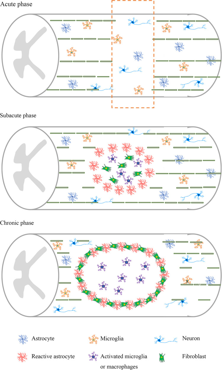 圖1：脊髓損傷不同階段的病理特點。