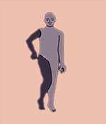 這種類型的腦癱表現為四肢僵硬。 這種類型的腦癱表現為四肢僵硬。