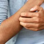 肝臟損傷的警告信號，肝臟疾病的警告信號 - 瘙癢