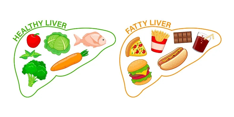 如何才能讓我的肝臟恢復(fù)健康? 如何才能讓我的肝臟恢復(fù)健康?