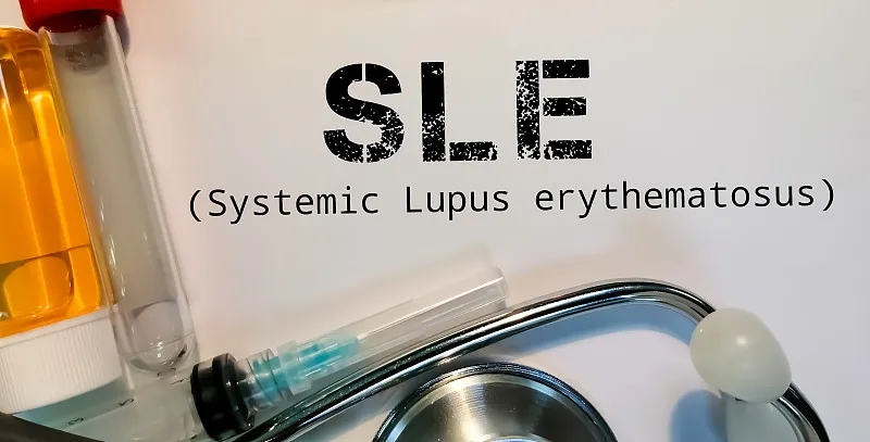 南京鼓樓醫(yī)院:干細(xì)胞治療在系統(tǒng)性紅斑狼瘡中維持長(zhǎng)期治療效果 南京鼓樓醫(yī)院:干細(xì)胞治療在系統(tǒng)性紅斑狼瘡中維持長(zhǎng)期治療效果