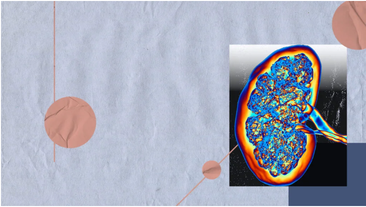 如何篩查糖尿病腎病-有哪些方法？