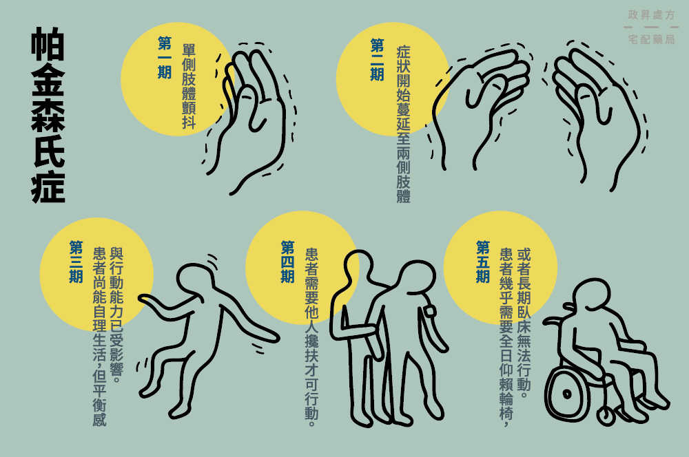 神經干細胞移植管理帕金森病:挑戰(zhàn)、納米技術支持和前景 神經干細胞移植管理帕金森病:挑戰(zhàn)、納米技術支持和前景