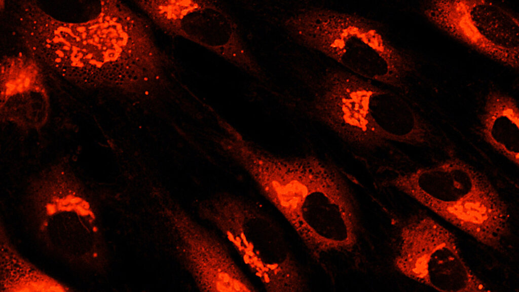 間充質(zhì)干細(xì)胞衍生療法和外泌體作為先進(jìn)療法的后起之秀 間充質(zhì)干細(xì)胞衍生療法和外泌體作為先進(jìn)療法的后起之秀