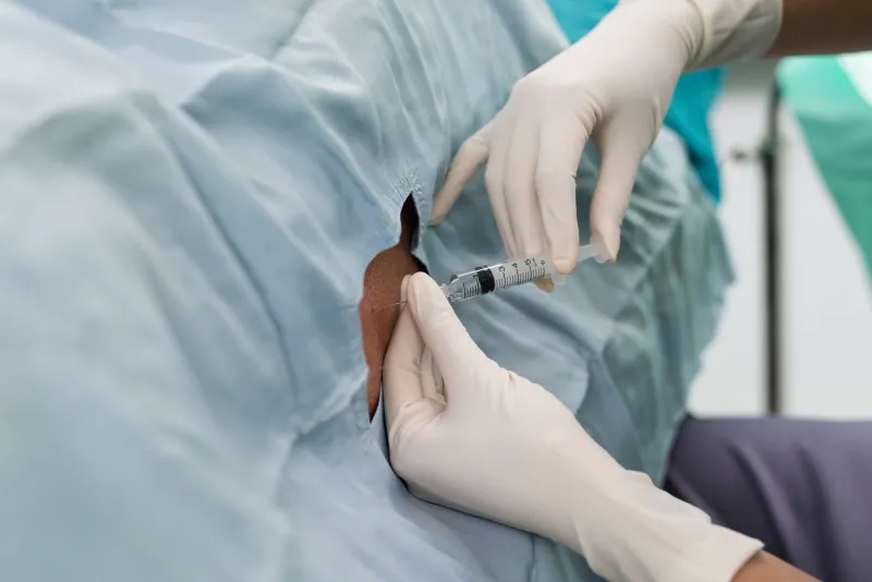 干細(xì)胞，-鞘內(nèi)給藥，-神經(jīng)系統(tǒng)疾病