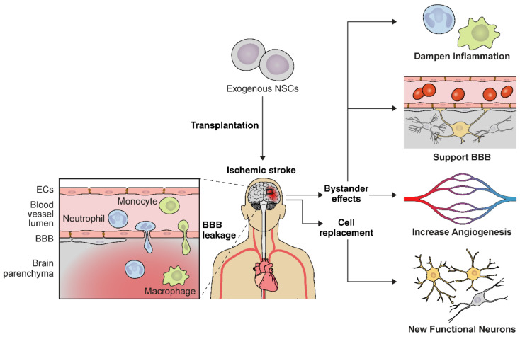 神經干細胞移植治療缺血性腦卒中的作用機制