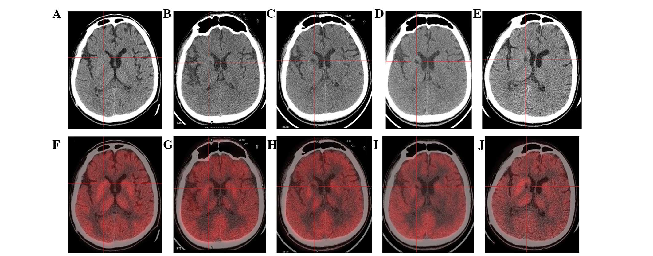 圖1:計算機斷層掃描 (CT) 和正電子發射斷層掃描 (PET) 掃描。 圖1:計算機斷層掃描 (CT) 和正電子發射斷層掃描 (PET) 掃描。