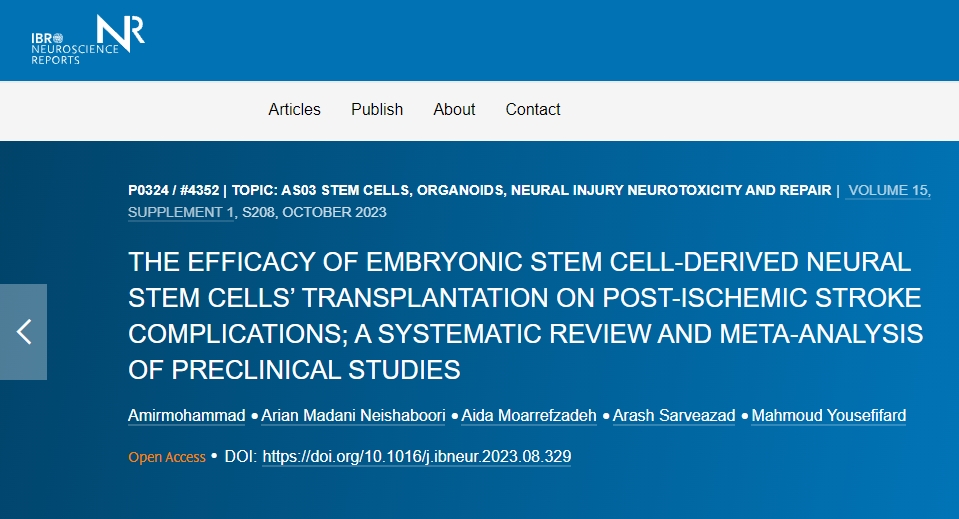 胚胎干細胞衍生的神經干細胞移植對缺血性中風后并發癥的功效如何? 胚胎干細胞衍生的神經干細胞移植對缺血性中風后并發癥的功效如何?
