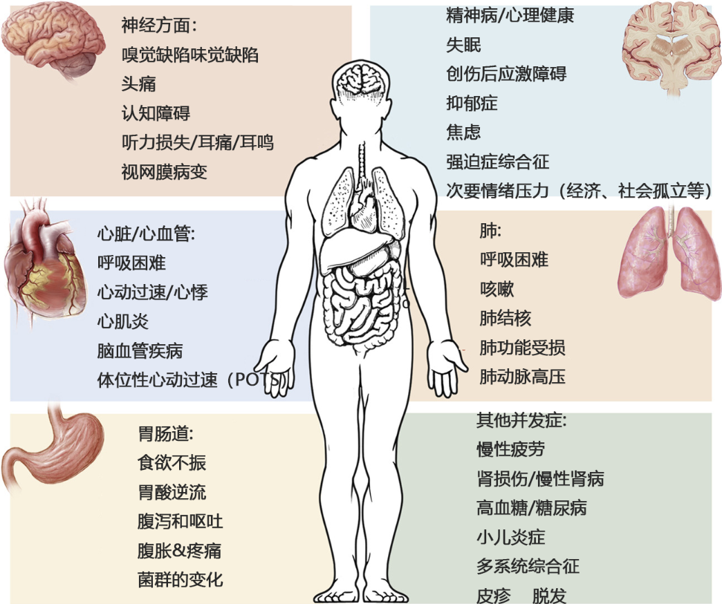 間充質干細胞可改善多種新冠后遺癥 間充質干細胞可改善多種新冠后遺癥