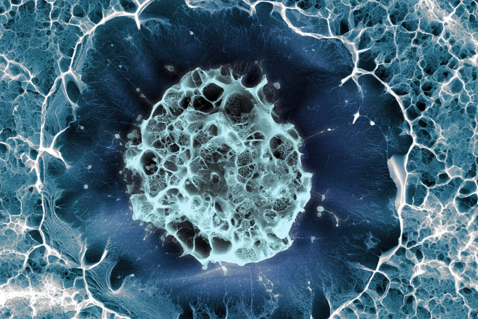 基于人類干細胞的帕金森病療法被證明是安全的 基于人類干細胞的帕金森病療法被證明是安全的