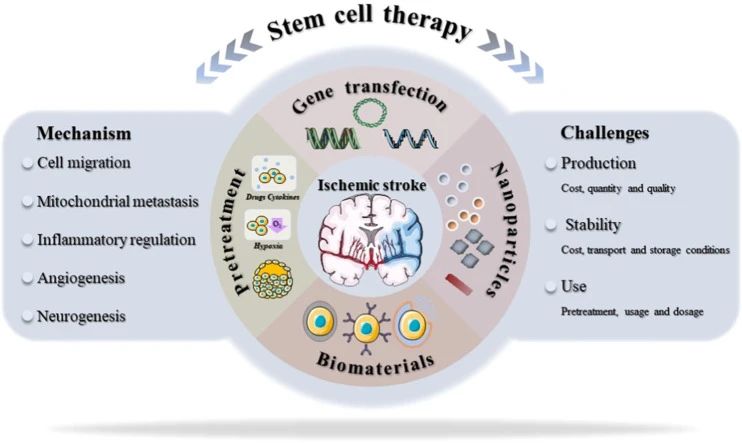 干細胞治療中風(fēng)新進展：一項206人的隨機臨床試驗結(jié)果揭曉啦！