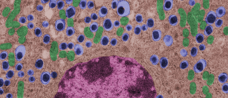 利用間充質干細胞治療1型糖尿病的潛力如何？