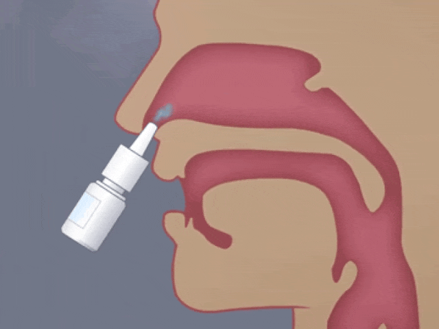 日本居家干細胞噴鼻能治療腦梗死:是科學(xué)突破還是商業(yè)噱頭? 日本居家干細胞噴鼻能治療腦梗死:是科學(xué)突破還是商業(yè)噱頭?