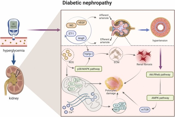圖1：糖尿病腎病的病理信號。