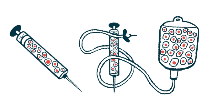 免疫調(diào)節(jié)性Tregs增強(qiáng)干細(xì)胞治療帕金森病的研究