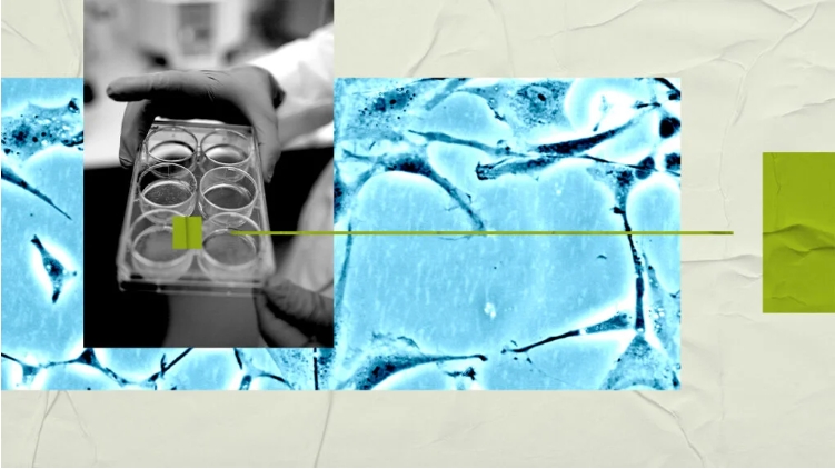 研究人員稱,大腦研究可能有助于開發新的精神分裂癥治療方法。 研究人員稱,大腦研究可能有助于開發新的精神分裂癥治療方法。