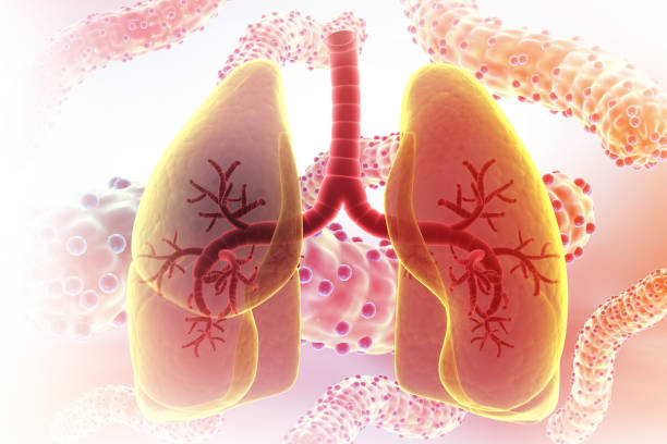 獲得國家藥監局批準！廣州醫科大學附屬第一醫院正在開展人臍帶源間充質干細胞注射液治療IPF臨床研究