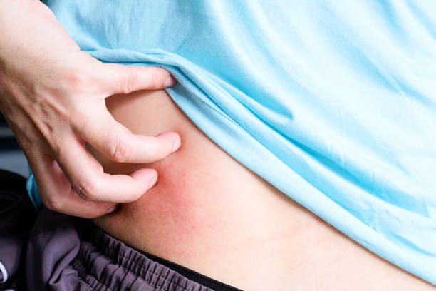 肝硬化肝腎綜合征的診斷、預(yù)防和治療 肝硬化肝腎綜合征的診斷、預(yù)防和治療