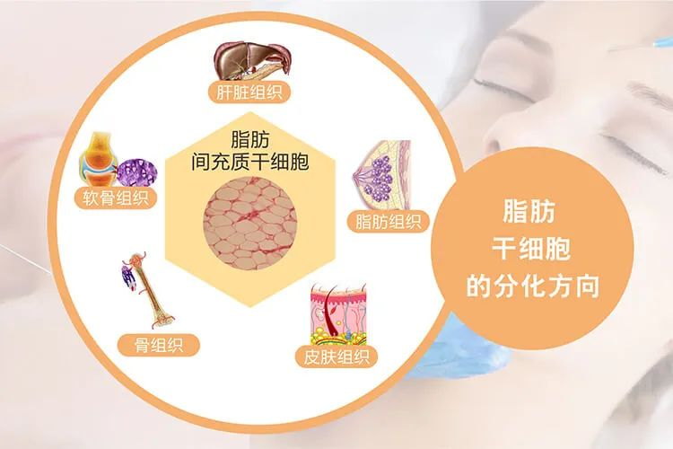 什么是脂肪干細胞:脂肪干細胞來源、臨床應用 什么是脂肪干細胞:脂肪干細胞來源、臨床應用