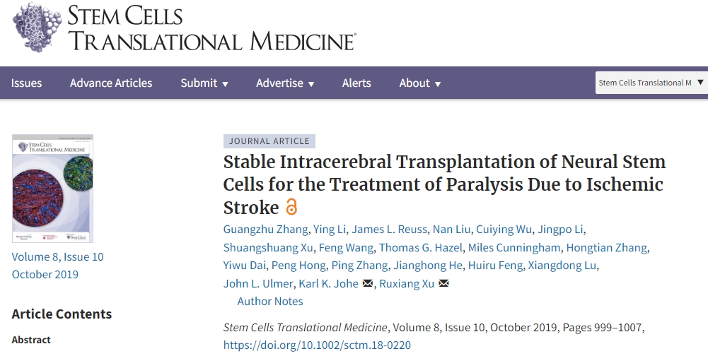 解放軍總醫院:神經干細胞移植治療缺血性中風,臨床表明效果良好! 解放軍總醫院:神經干細胞移植治療缺血性中風,臨床表明效果良好!