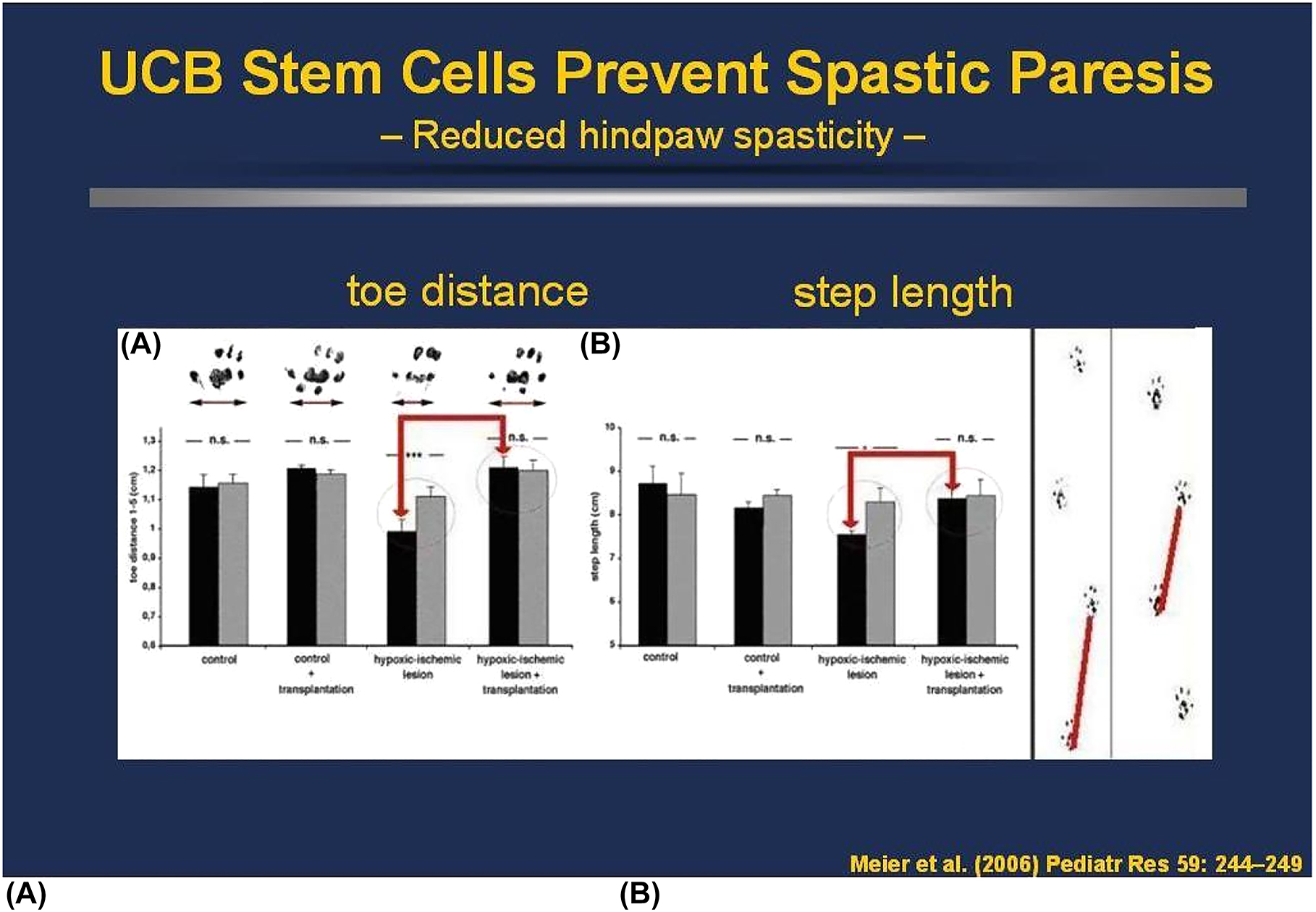 人類臍帶血MNC可預(yù)防PN7新生大鼠模型的痙攣性輕癱 人類臍帶血MNC可預(yù)防PN7新生大鼠模型的痙攣性輕癱