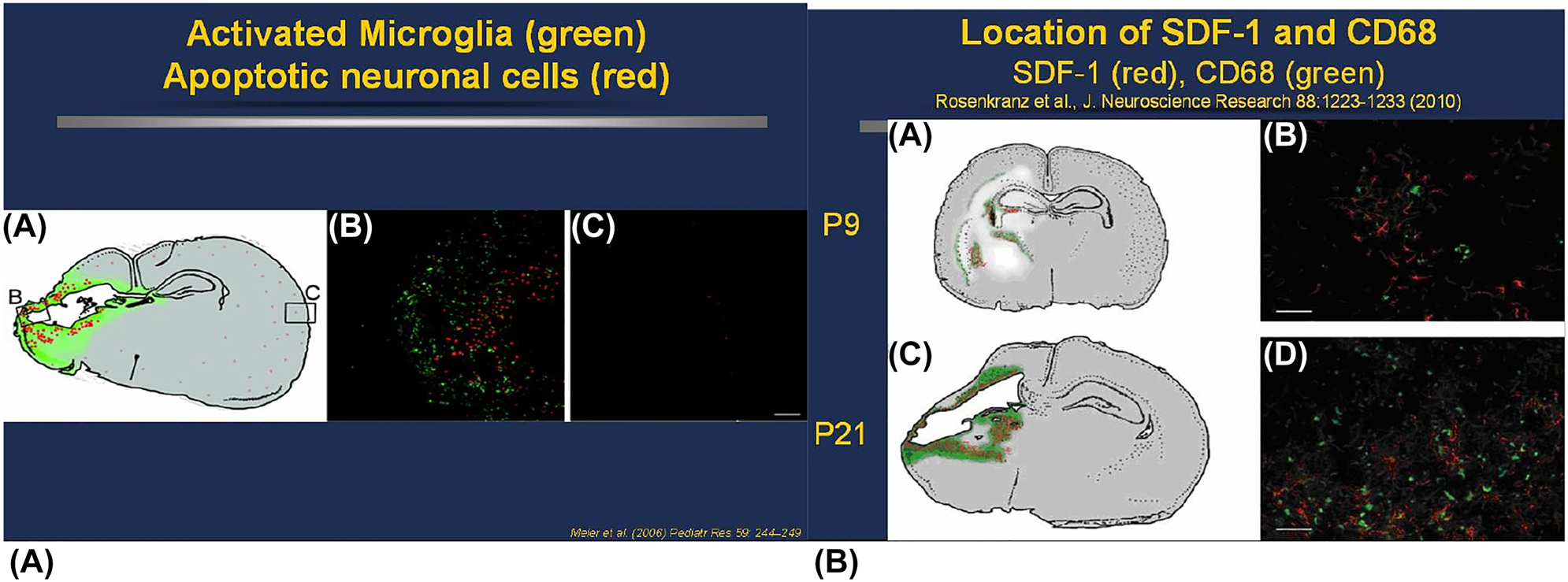 新生大鼠PN9和 PN21 HI后激活的小膠質(zhì)細(xì)胞和SDF-1表達(dá) 新生大鼠PN9和 PN21 HI后激活的小膠質(zhì)細(xì)胞和SDF-1表達(dá)