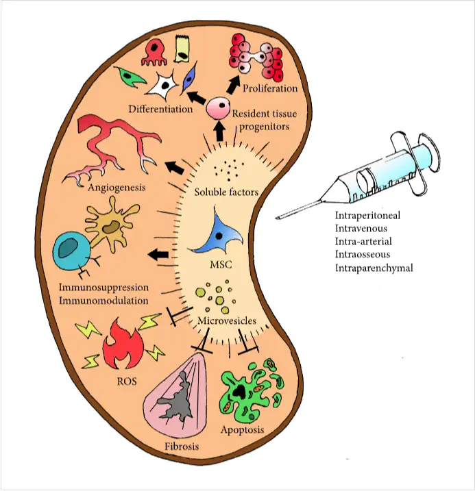 干細胞如何治療腎臟疾病？