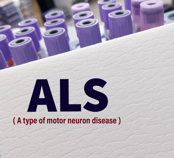 干細胞治療漸凍癥：78例患者的安全性與有效性驗證