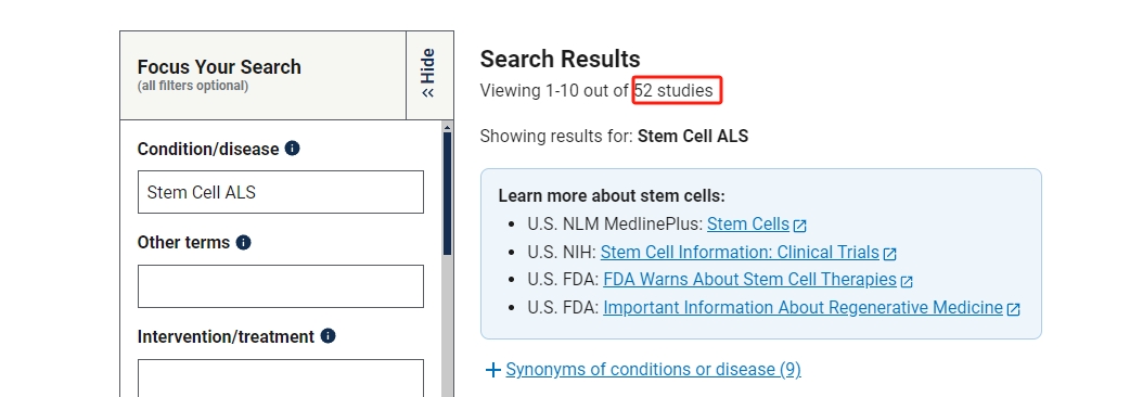 干細胞治療漸凍癥的臨床研究進展