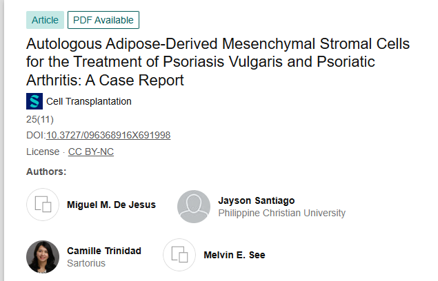 《自體脂肪來源的間充質基質細胞治療尋常型銀屑病和銀屑病關節炎：病例報告》