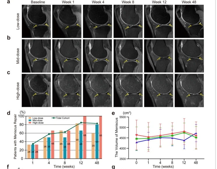 a – c不同劑量組膝關節 MRI 掃描中的半月板損傷。d半月板修復患者百分比。e注射后六個時間點的半月板體積分析。 a – c不同劑量組膝關節 MRI 掃描中的半月板損傷。d半月板修復患者百分比。e注射后六個時間點的半月板體積分析。