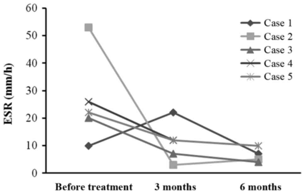 每位患者治療前后的 CRP 水平。1 名患者的 CRP 水平降低，而其他 4 名患者的 CRP 水平保持穩定并在正常范圍內。CRP，C 反應蛋白。