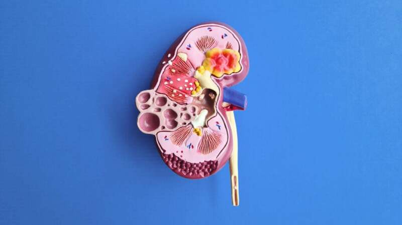 薈萃分析|12項研究表明干細胞治療可以改善狼瘡性腎炎患者的腎功能損傷 薈萃分析|12項研究表明干細胞治療可以改善狼瘡性腎炎患者的腎功能損傷