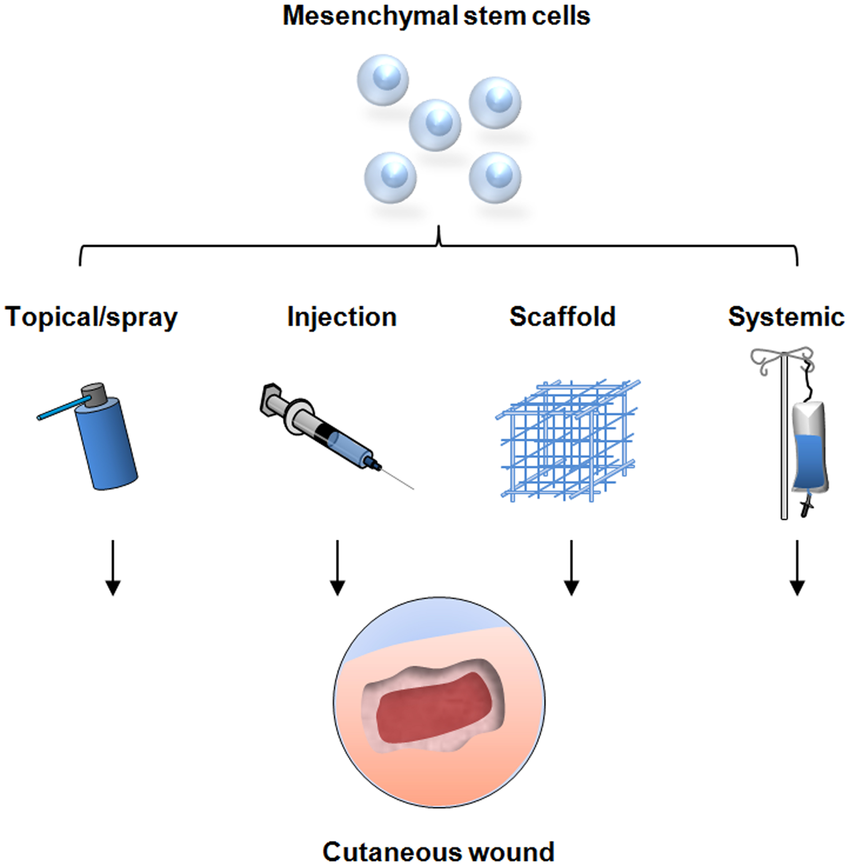 間充質干細胞的治療方式有哪些—從傳統細胞移植到現代生物技術的應用 間充質干細胞的治療方式有哪些—從傳統細胞移植到現代生物技術的應用